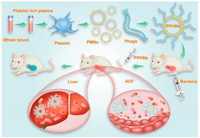 Membrane-camouflaged biomimetic nanoparticles as potential immunomodulatory solutions for sepsis: An overview